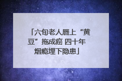 六旬老人唇上“黄豆”拖成癌 四十年烟瘾埋下隐患