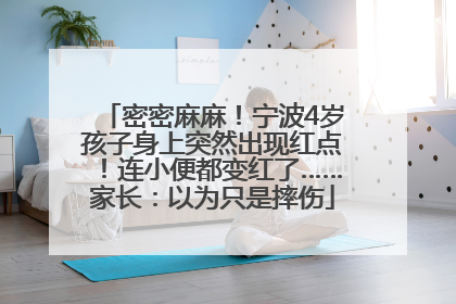 密密麻麻！宁波4岁孩子身上突然出现红点！连小便都变红了……家长：以为只是摔伤